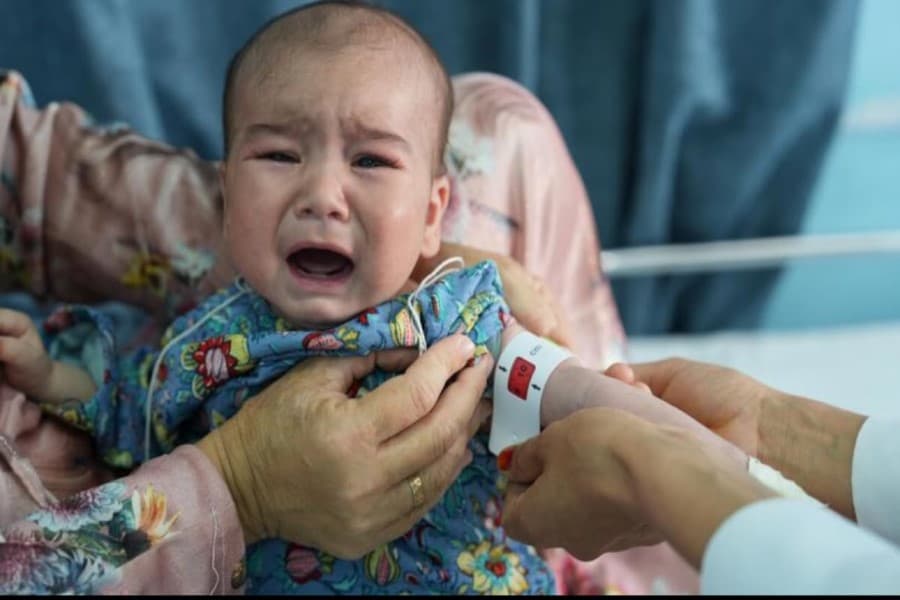 Əfqanıstanda 3,7 milyon uşaq kəskin qidalanma çatışmazlığından əziyyət çəkir