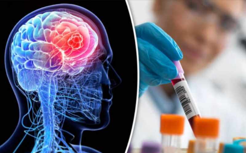 Sirli Beyin Xəstəliyi: Gizli epidemiya, yoxsa sui-qəsd?