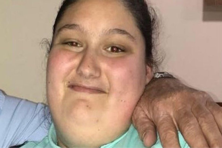15 yaşlı kök qızın ölümündə valideynləri günahlandırıldı - ÖZƏL